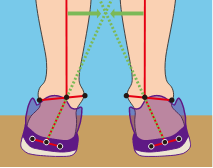 LOWアーチの足首